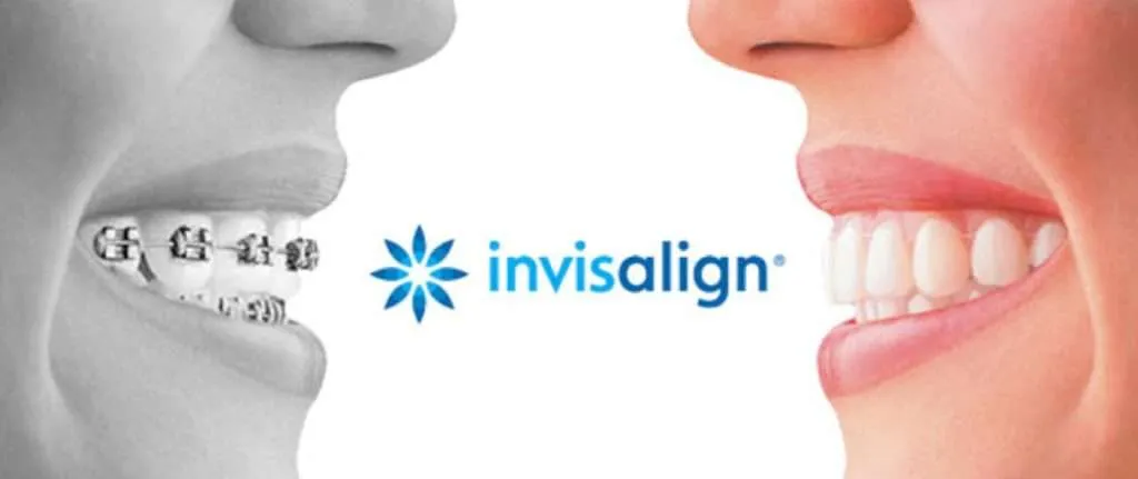 what-is-invisalign